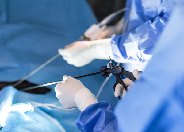 Laparoscopic Hysterectomy