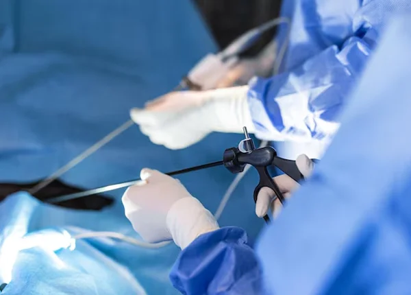 Laparoscopic Hysterectomy