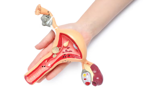 Vaginal Prolapse