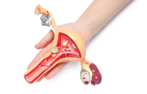 Vaginal Prolapse